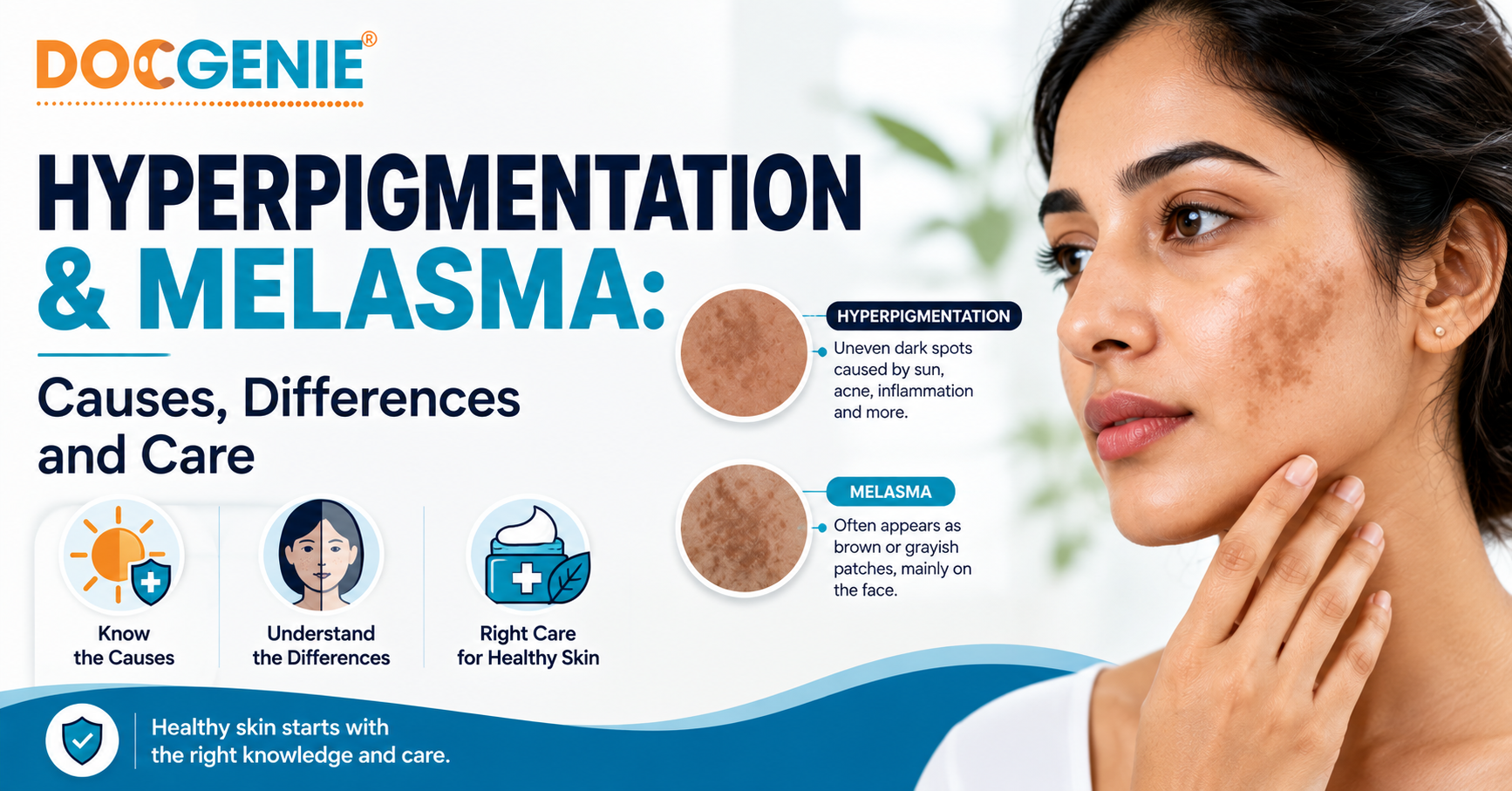 Hyperpigmentation and Melasma: Causes, Differences and Care