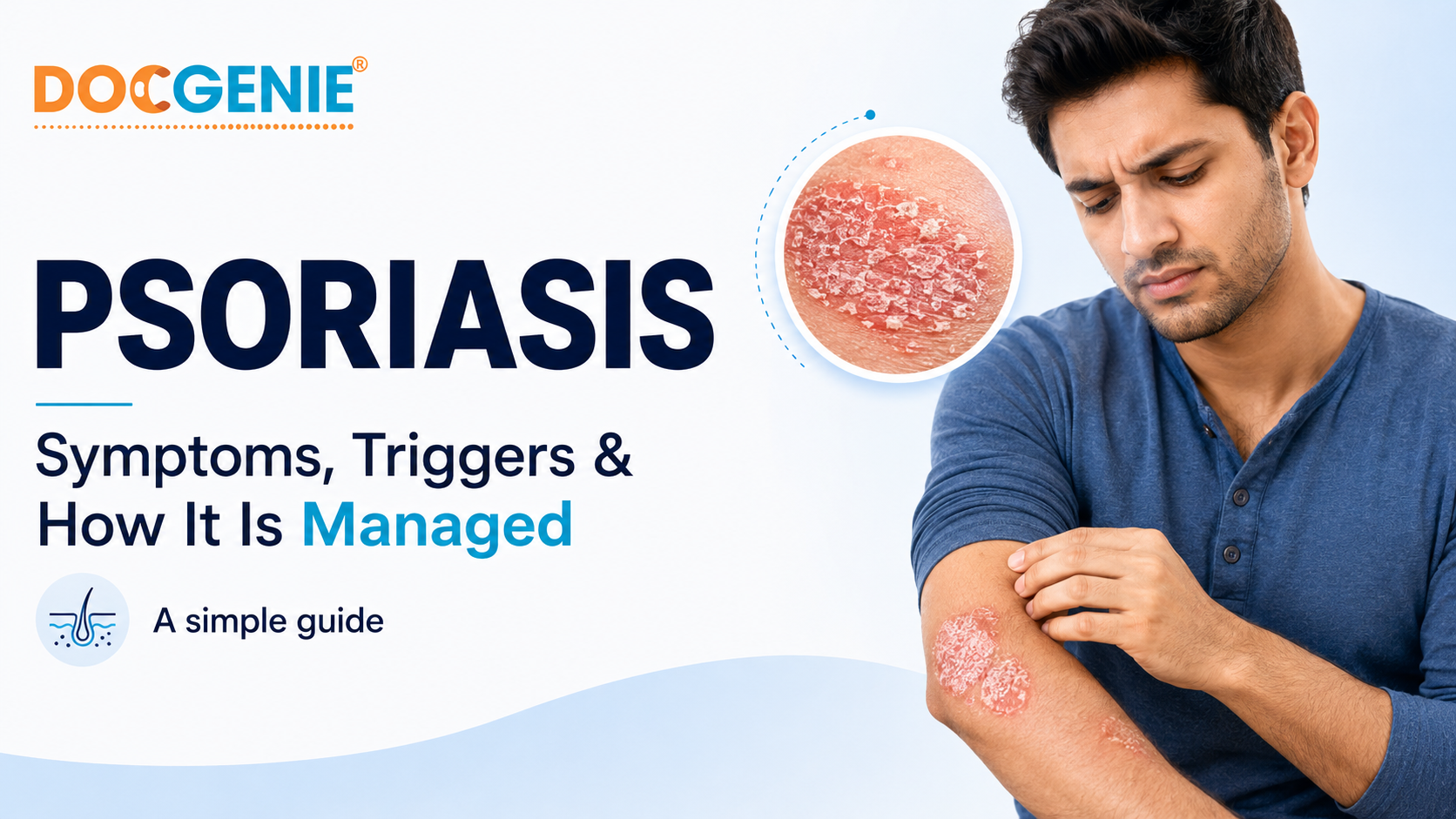 Psoriasis: Symptoms, Triggers and How It Is Managed